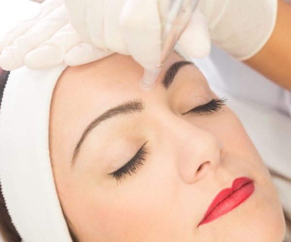 SKin Needling SKin Needling