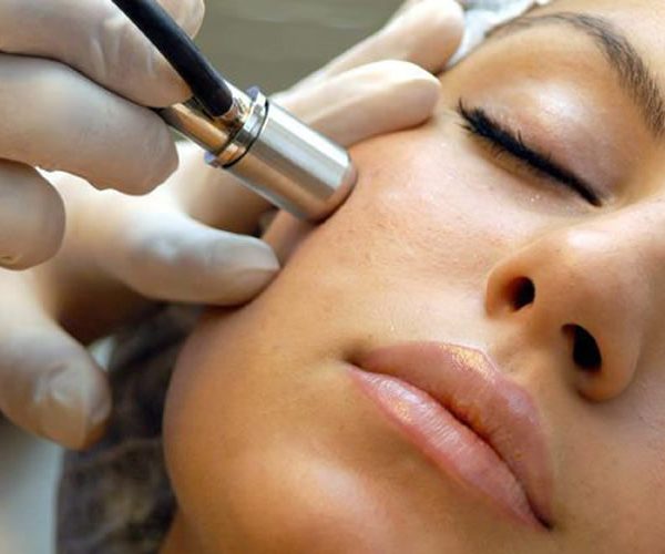 microdermabrasion-wakefield microdermabrasion-wakefield